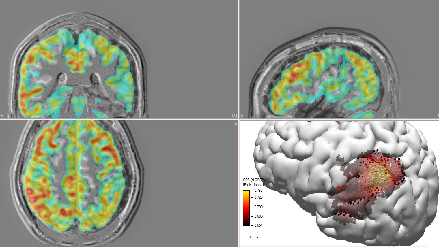 Sz source 2024 and PET2 
